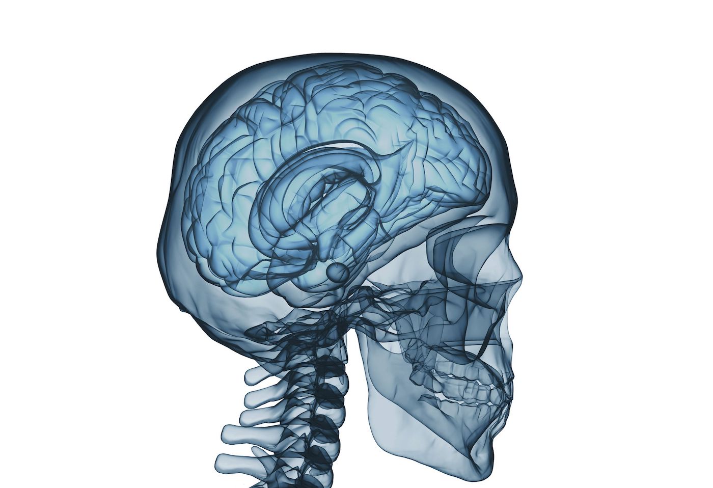 brain and skull x ray image isolated on white