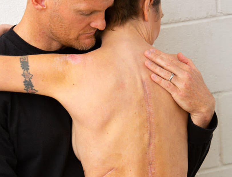 Surgery patient story